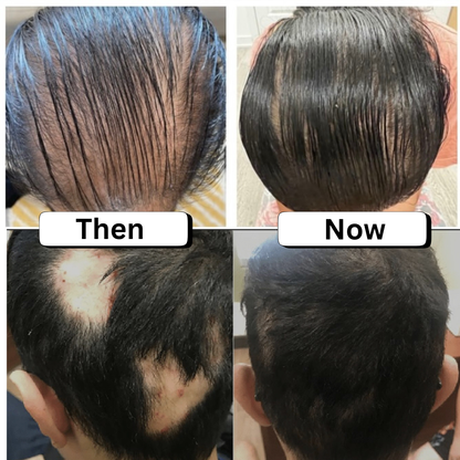 #1 Sclap Stimulator Hair Oil