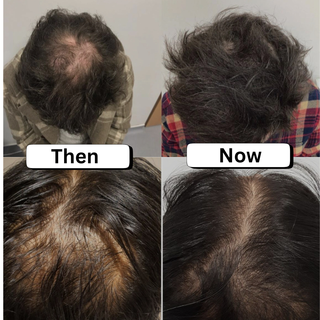 #1 Sclap Stimulator Hair Oil