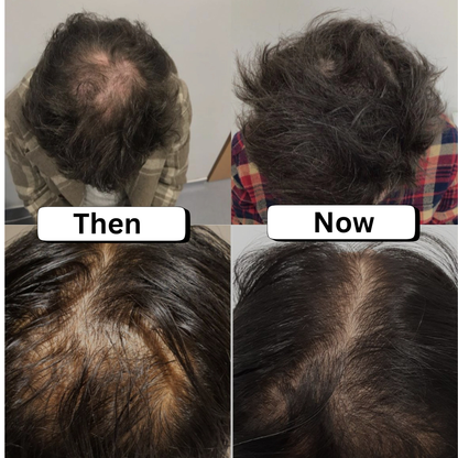 #1 Sclap Stimulator Hair Oil